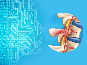 AI and Robotics to Aid Spinal Cord Injuries