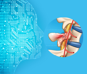 AI and Robotics to Aid Spinal Cord Injuries